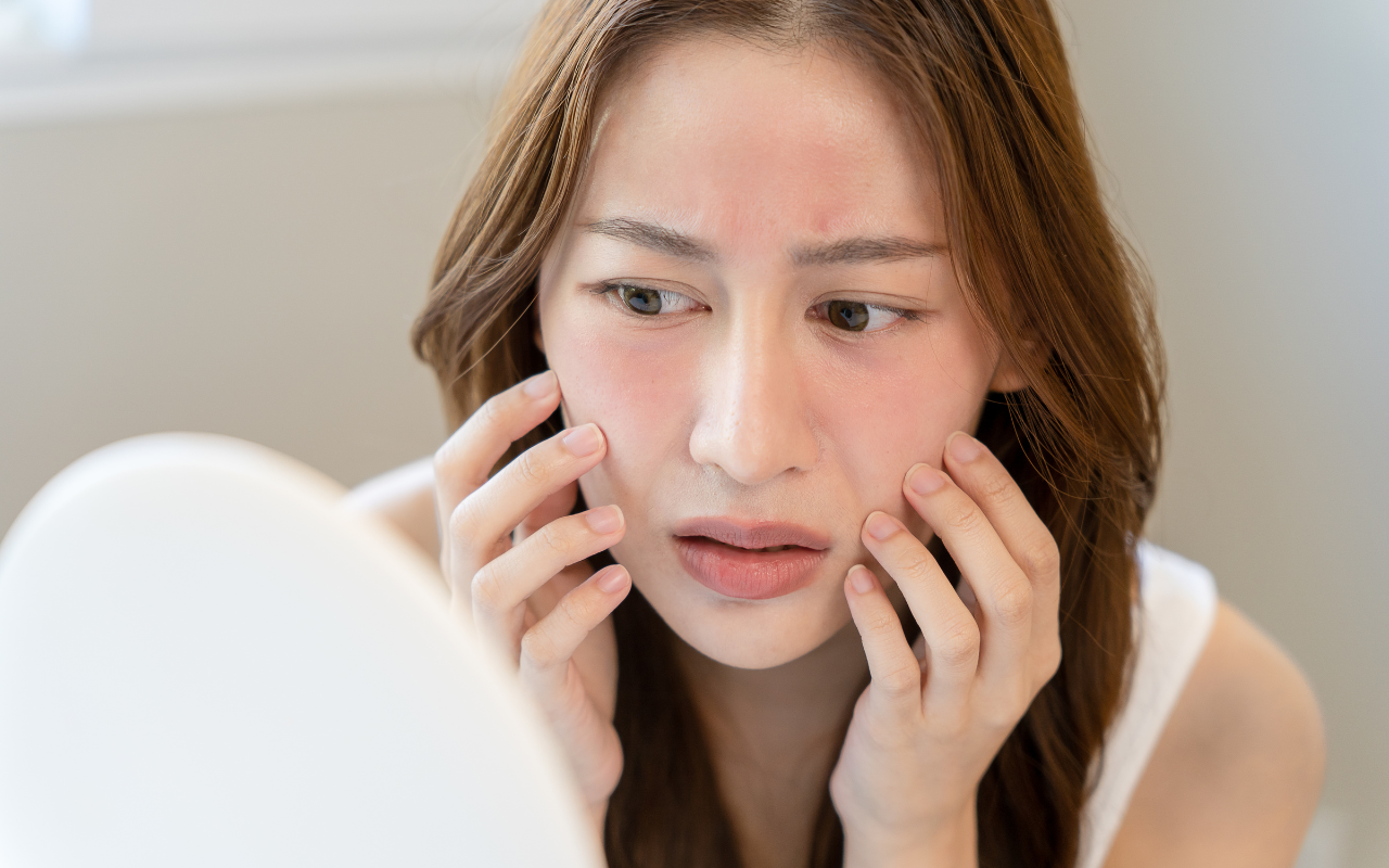 You are currently viewing Struggling with Sensitive Skin? This 100% Natural Cream Might Be the Answer!